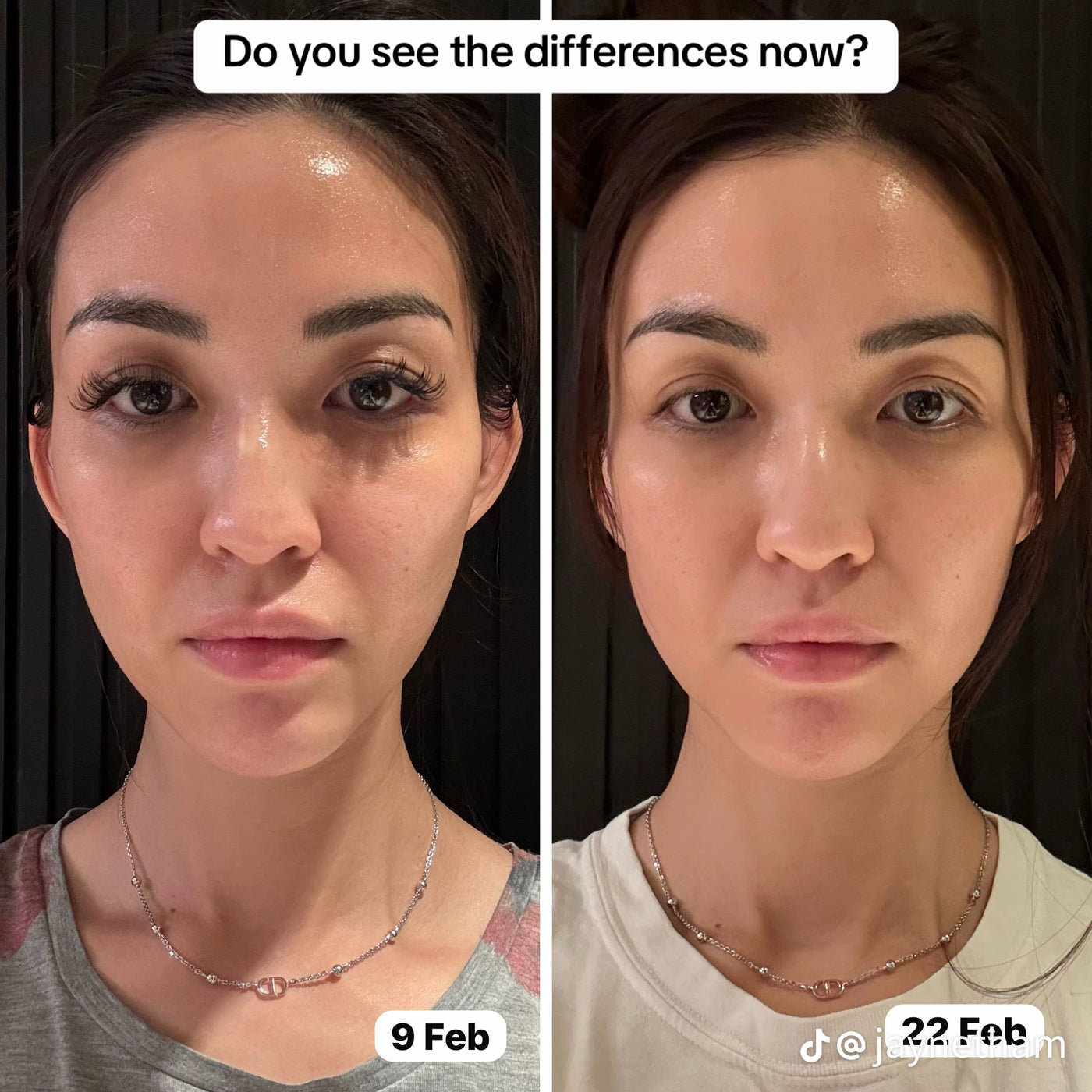 Nourgen - Natural Collagen Powder