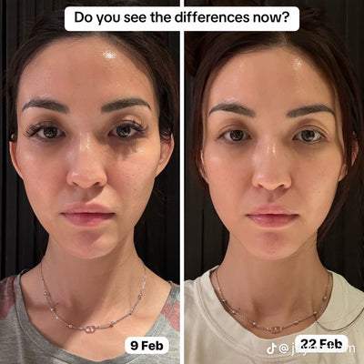 Nourgen - Natural Collagen Powder